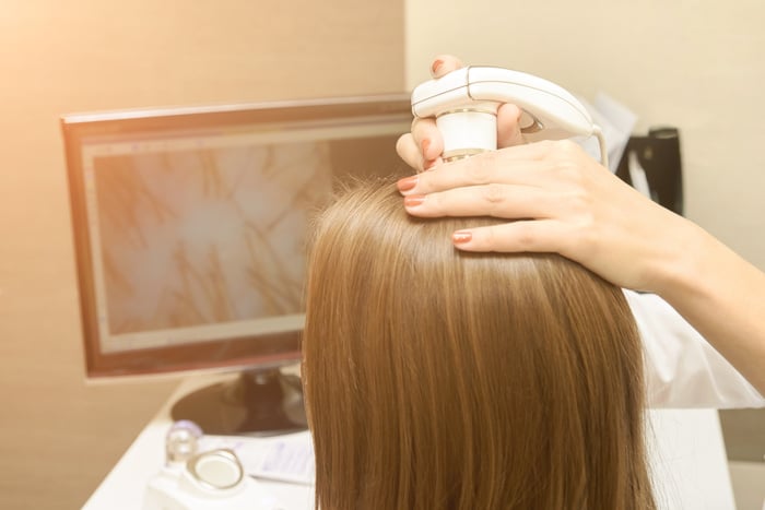 Woman Having Scalp Treatment at the Clinic