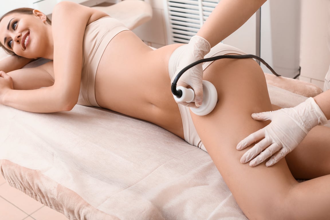 Woman Receiving Cellulite Removal Treatment at Clinic